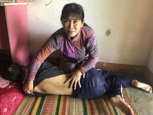 Thương cảnh mẹ đơn thân nuôi con bại não, động kinh - 2 Thương cảnh mẹ đơn thân nuôi con bại não, động kinh - 2