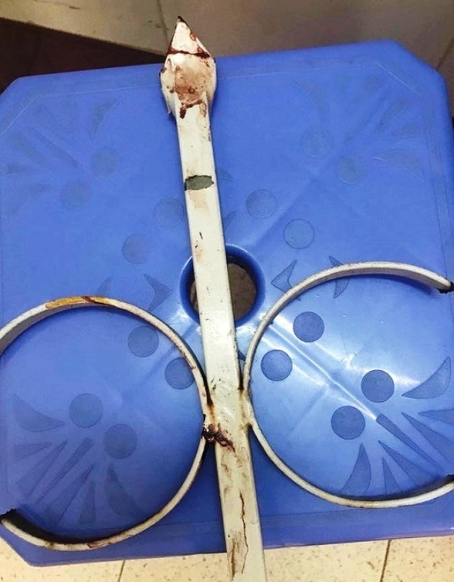 Nổi da gà với hình ảnh bảo vệ bị cọc sắt đâm dính chặt tay vào tường rào - 2 Nổi da gà với hình ảnh bảo vệ bị cọc sắt đâm dính chặt tay vào tường rào - 2