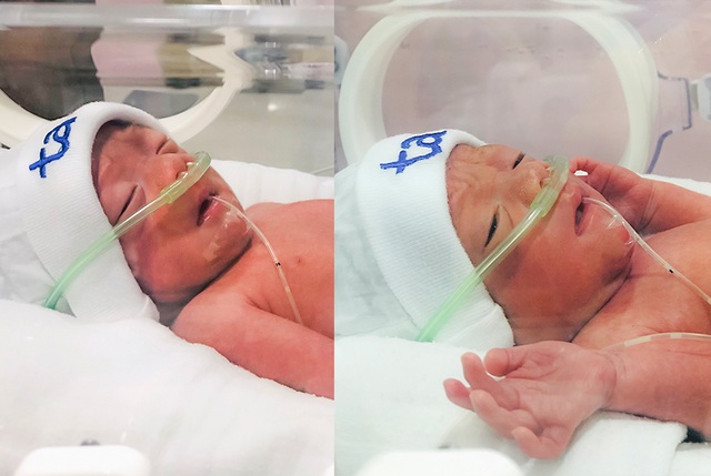 Nghẹt thở ca mổ bắt con “độc nhất vô nhị” trong ngành sản khoa - 3 Nghẹt thở ca mổ bắt con “độc nhất vô nhị” trong ngành sản khoa - 3