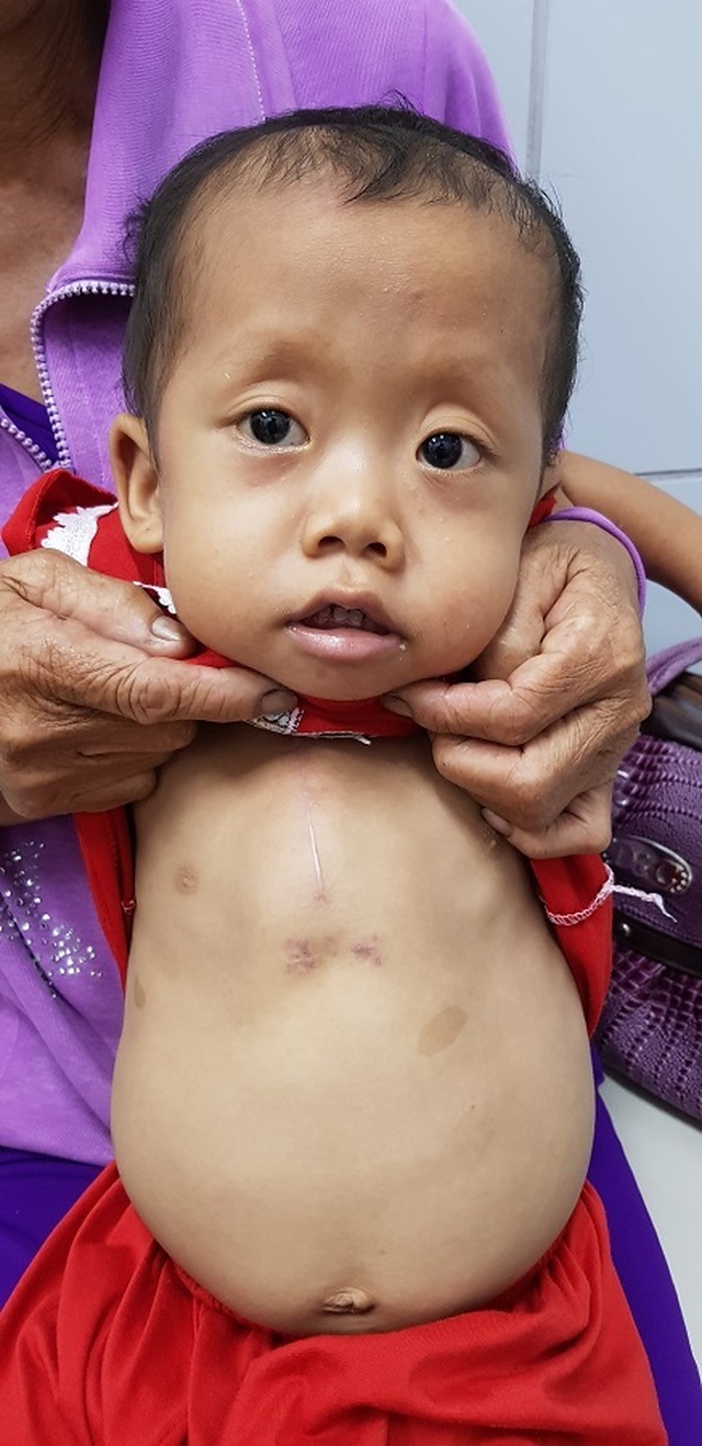 Hơn 112 triệu đồng của bạn đọc Dân trí đến với cháu bé bị bệnh tim - 2 Hơn 112 triệu đồng của bạn đọc Dân trí đến với cháu bé bị bệnh tim - 2