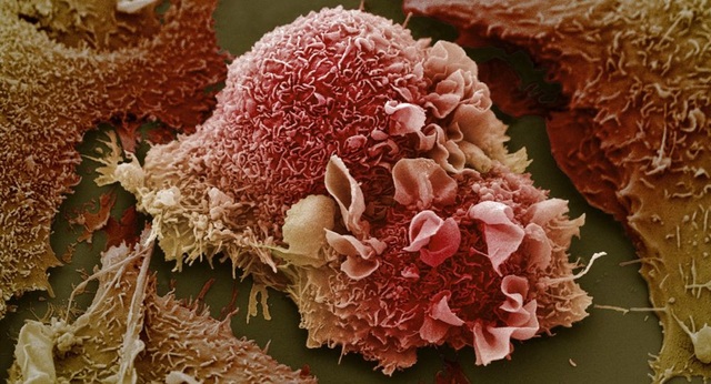 Khoa học phát hiện phương pháp điều trị ung thư mới - 1
