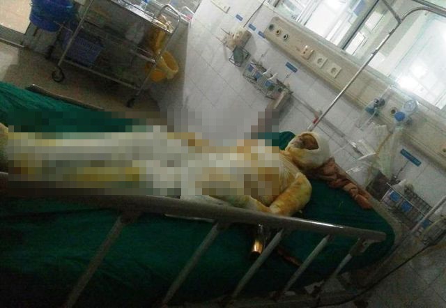 Con trai đổ xăng lên người 2 bố con tự thiêu - 1 Con trai đổ xăng lên người 2 bố con tự thiêu - 1