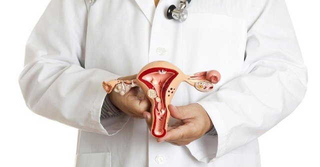 Vì sao Nga Phụ Khang lại có thể hỗ trợ điều trị u xơ tử cung không cần phẫu thuật? - 1 Vì sao Nga Phụ Khang lại có thể hỗ trợ điều trị u xơ tử cung không cần phẫu thuật? - 1
