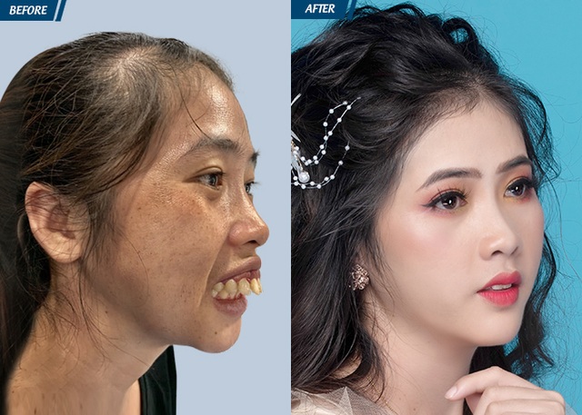 Từng bị kì thị vì ngoại hình, 9X Bình Thuận thay đổi ngoạn mục - 6 Từng bị kì thị vì ngoại hình, 9X Bình Thuận thay đổi ngoạn mục - 6