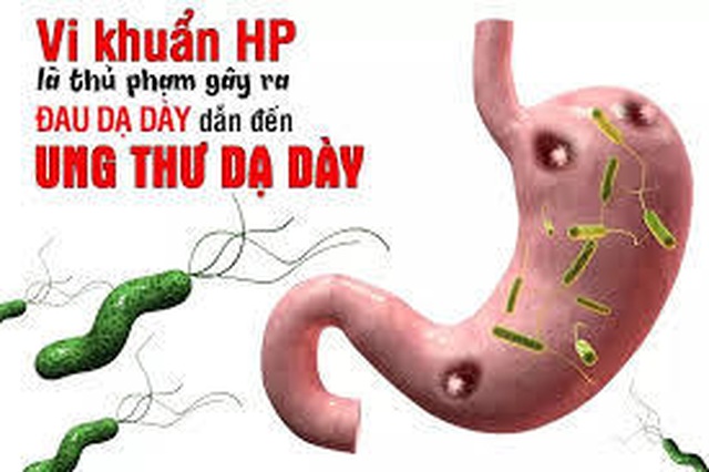Vi khuẩn HP có gene Cag A sẽ gây ung thư dạ dày? - 1 Vi khuẩn HP có gene Cag A sẽ gây ung thư dạ dày? - 1