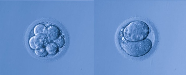 5 cặp vợ chồng người Nga đã đồng ý sử dụng chỉnh sửa gene để con không bị điếc? - 1 5 cặp vợ chồng người Nga đã đồng ý sử dụng chỉnh sửa gene để con không bị điếc? - 1
