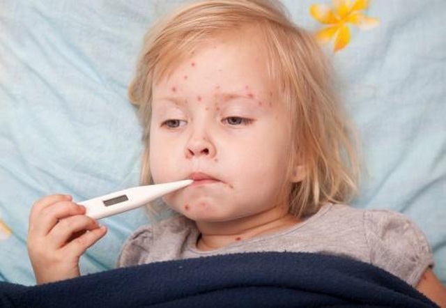 Vì sao gel Subạc có thể hỗ trợ điều trị bệnh thủy đậu ở trẻ em hiệu quả đến vậy? - 3