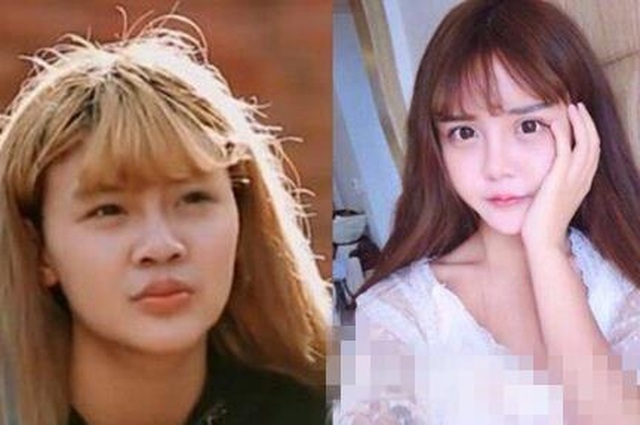 Cô gái Trung Quốc 20 tuổi phẫu thuật thẩm mỹ tổng cộng 33 lần - 2 Cô gái Trung Quốc 20 tuổi phẫu thuật thẩm mỹ tổng cộng 33 lần - 2