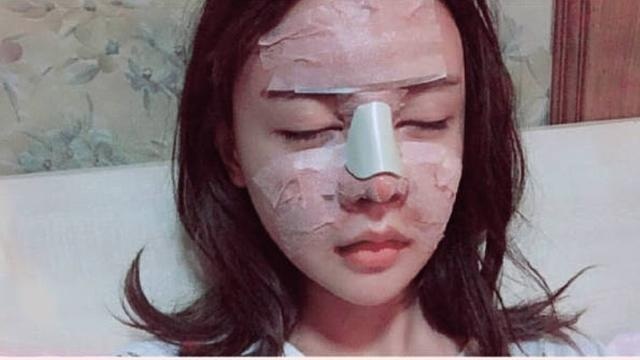 Cô gái Trung Quốc 20 tuổi phẫu thuật thẩm mỹ tổng cộng 33 lần - 3