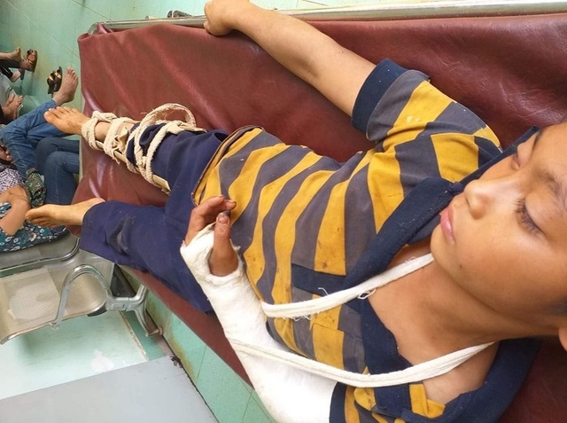 Bé trai 11 tuổi nghi bị hàng xóm đánh đập trọng thương - 1 Bé trai 11 tuổi nghi bị hàng xóm đánh đập trọng thương - 1