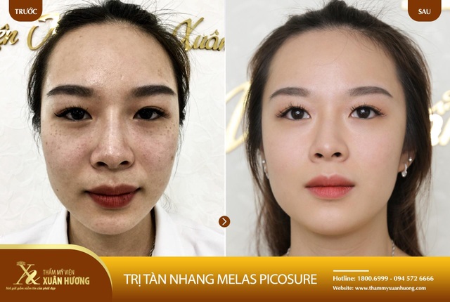 Thẩm mỹ viện Xuân Hương trợ giá thẩm mỹ lên tới 10 tỷ đồng dịp khai trương - 5 Thẩm mỹ viện Xuân Hương trợ giá thẩm mỹ lên tới 10 tỷ đồng dịp khai trương - 5