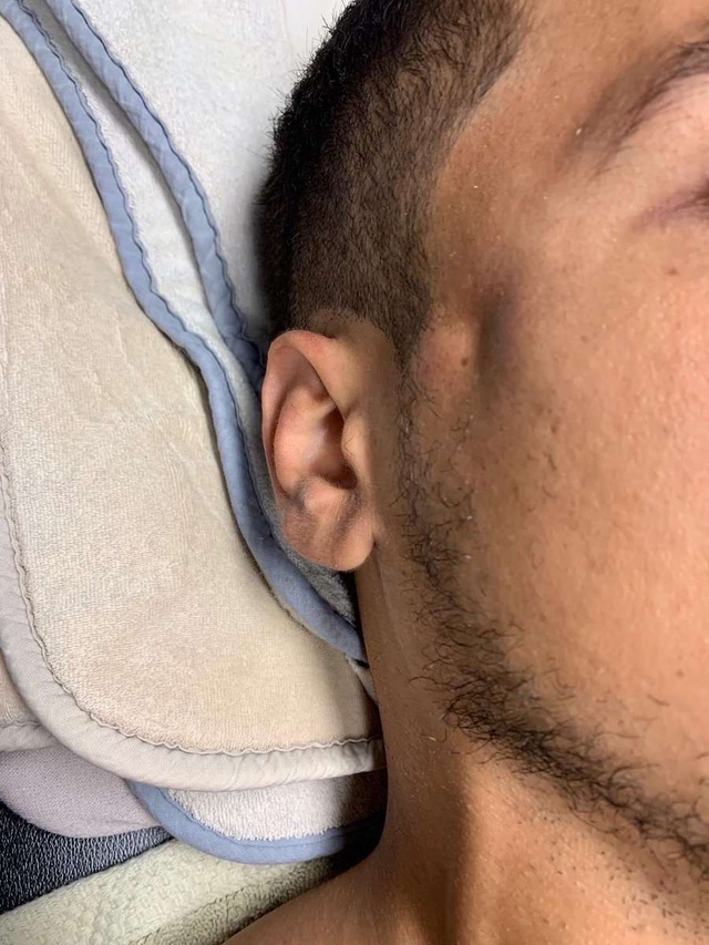 Lĩnh trọn cú thúc cùi chỏ của Ibrahimovic, cầu thủ nhập viện vì nứt xương sọ Lĩnh trọn cú thúc cùi chỏ của Ibrahimovic, cầu thủ nhập viện vì nứt xương sọ