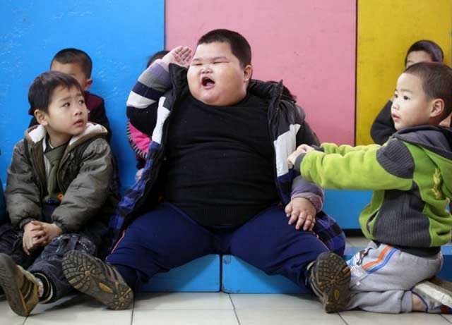Báo động tình trạng thiếu đói, suy dinh dưỡng và béo phì ở khu vực châu Á - 1 Báo động tình trạng thiếu đói, suy dinh dưỡng và béo phì ở khu vực châu Á - 1