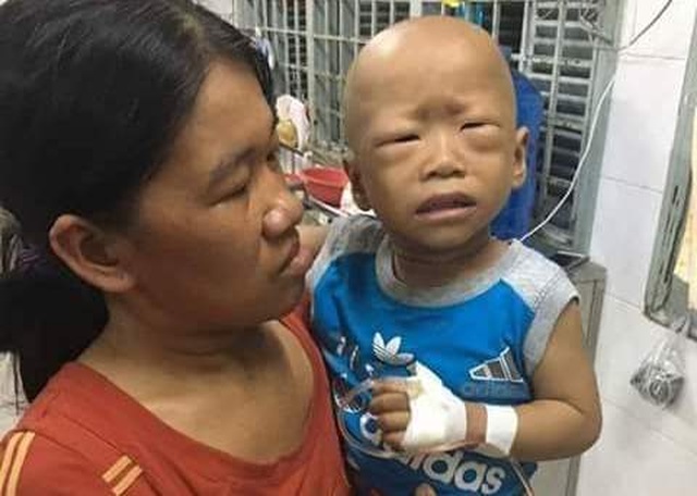 Xót xa cảnh cháu bé 3 tuổi quằn quại trong cơn đau vì ung thư quái ác hành hạ - 1 Xót xa cảnh cháu bé 3 tuổi quằn quại trong cơn đau vì ung thư quái ác hành hạ - 1