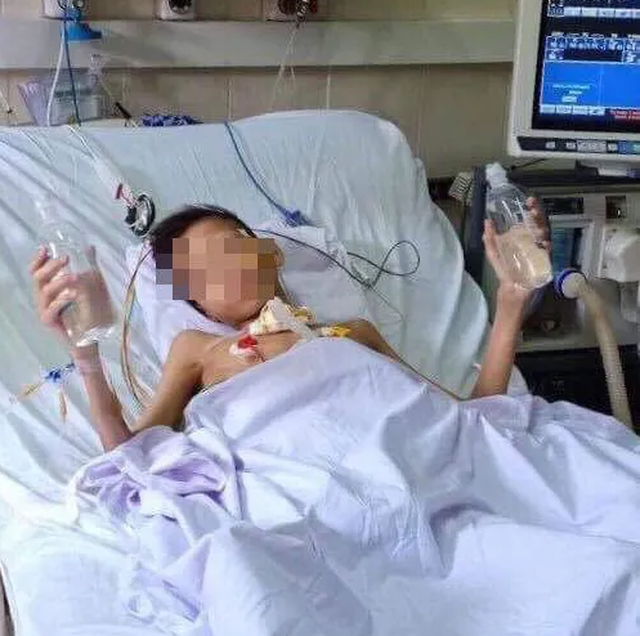 Cuộc chiến âm thầm 8 tháng hồi sức giúp nam thanh niên được ghép phổi đang dần hồi phục - 1 Cuộc chiến âm thầm 8 tháng hồi sức giúp nam thanh niên được ghép phổi đang dần hồi phục - 1