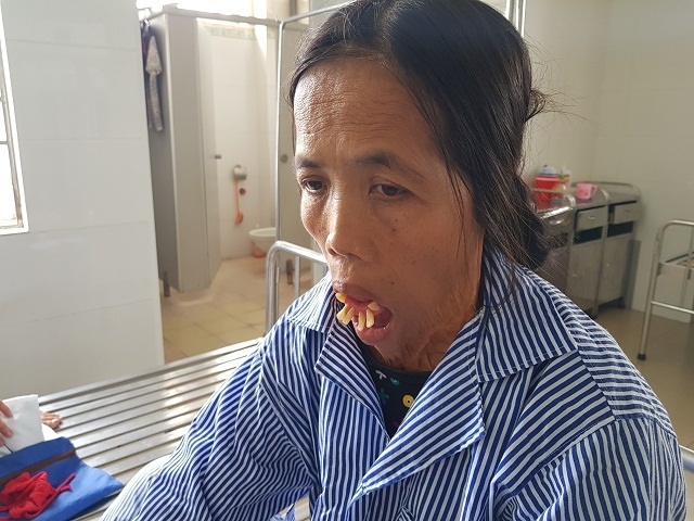 Sau nửa thế kỉ, người đàn bà có hàm răng “kỳ dị” rụt rè khi lần đầu nhập viện - 5 Sau nửa thế kỉ, người đàn bà có hàm răng “kỳ dị” rụt rè khi lần đầu nhập viện - 5