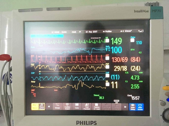 Bệnh nhân hồi phục thần tốc sau ca ghép tim thành công - 4 Bệnh nhân hồi phục thần tốc sau ca ghép tim thành công - 4
