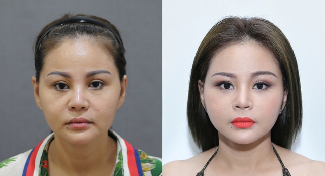 Lê Giang 18 năm miệt mài “dao kéo” khiến con trai lo “có ngày không nhận ra mẹ” - 7 Lê Giang 18 năm miệt mài “dao kéo” khiến con trai lo “có ngày không nhận ra mẹ” - 7