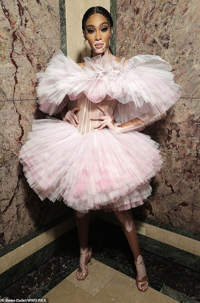 Siêu mẫu bạch biến Winnie Harlow nổi bật tại tuần lễ thời trang New York - 1 Siêu mẫu bạch biến Winnie Harlow nổi bật tại tuần lễ thời trang New York - 1