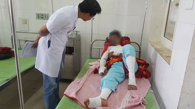 Điện thoại phát nổ khi chơi game vừa cắm sạc, thanh niên bị bỏng nặng - 1 Điện thoại phát nổ khi chơi game vừa cắm sạc, thanh niên bị bỏng nặng - 1