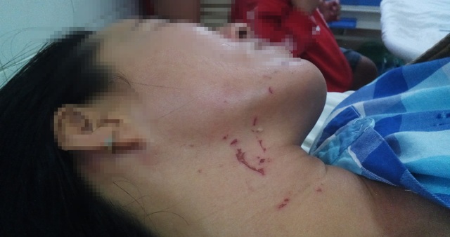 Chồng đánh vợ tàn nhẫn, liên tục quăng quật, dìm đầu vợ xuống nước - 2 Chồng đánh vợ tàn nhẫn, liên tục quăng quật, dìm đầu vợ xuống nước - 2