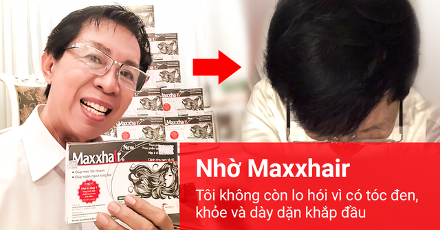 Chữa hói đầu sớm, rụng tóc nhiều: Biết trước điều này thật đáng giá biết bao nhiêu! - 4 Chữa hói đầu sớm, rụng tóc nhiều: Biết trước điều này thật đáng giá biết bao nhiêu! - 4