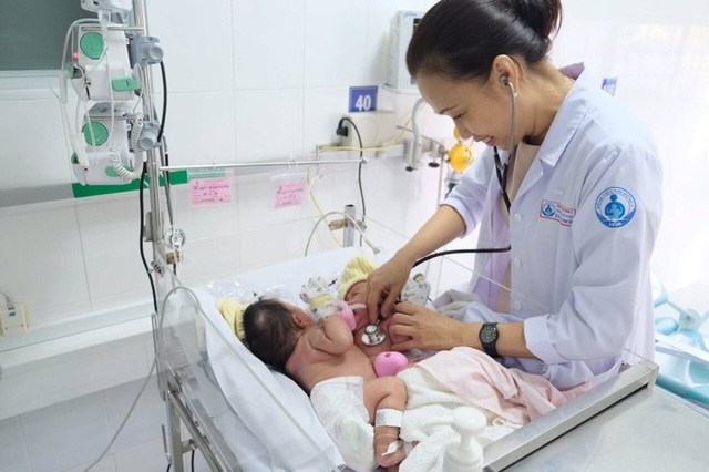 Cặp song sinh dính liền vùng bụng đã được tách thành công - 1 Cặp song sinh dính liền vùng bụng đã được tách thành công - 1
