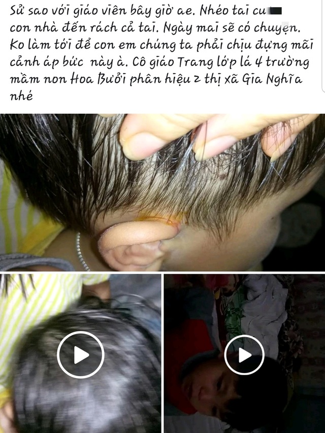 Xác minh thông tin cô giáo mầm non nhắc nhở… rách cả tai học sinh - 1 Xác minh thông tin cô giáo mầm non nhắc nhở… rách cả tai học sinh - 1