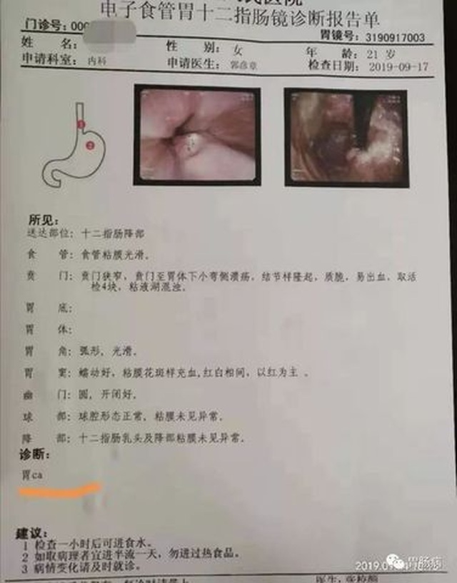 Cô gái 21 tuổi đã bị ung thư, bác sĩ cảnh báo thói quen xấu ở giới trẻ - 1 Cô gái 21 tuổi đã bị ung thư, bác sĩ cảnh báo thói quen xấu ở giới trẻ - 1