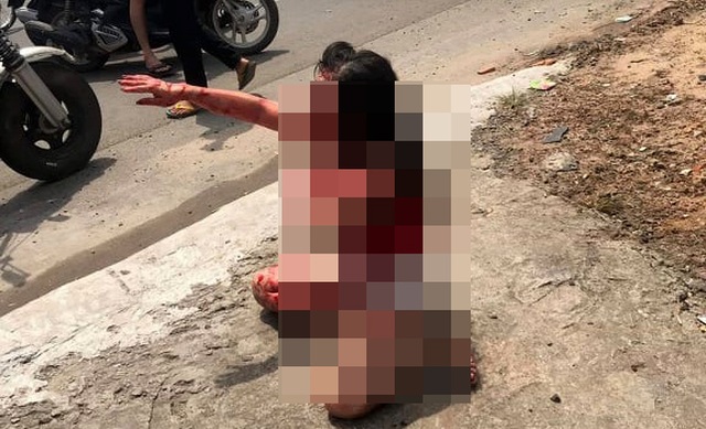 Nữ nhân viên quán cà phê gào khóc hoảng loạn bên đường vì bị “chồng hờ” hành hung dã man - 1 Nữ nhân viên quán cà phê gào khóc hoảng loạn bên đường vì bị “chồng hờ” hành hung dã man - 1