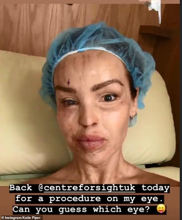 MC truyền hình Katie Piper hé lộ ảnh bị tạt axít - 5 MC truyền hình Katie Piper hé lộ ảnh bị tạt axít - 5