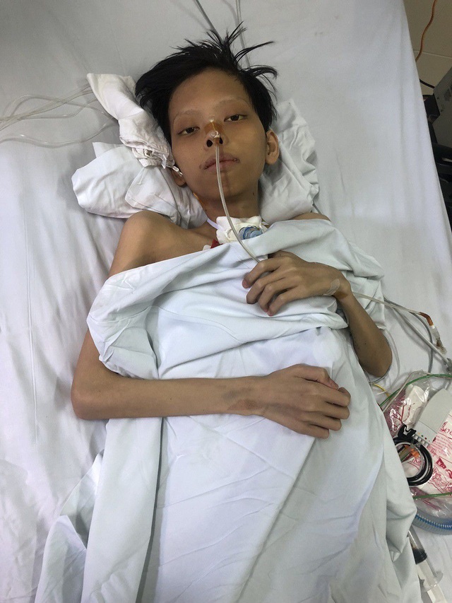 Chàng thanh niên siêu còi và hành trình nằm viện 300 ngày nhiều lần chết đi sống lại - 1 Chàng thanh niên siêu còi và hành trình nằm viện 300 ngày nhiều lần chết đi sống lại - 1
