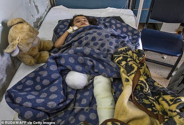 Những đứa trẻ Syria bị trúng bom trong chiến sự dữ dội của Thổ Nhĩ Kỳ - Ảnh minh hoạ 6