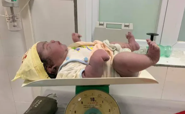 Sản phụ sinh thường bé gái nặng 5,5kg trong niềm vui bất ngờ - 1 Sản phụ sinh thường bé gái nặng 5,5kg trong niềm vui bất ngờ - 1