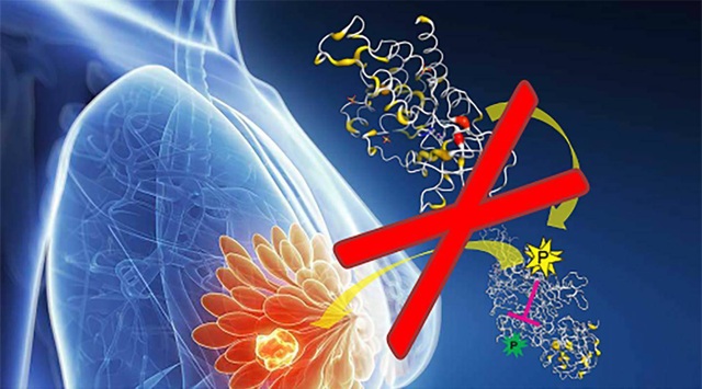 Sự thật đáng sợ: Ai cũng có thể mắc ung thư dù sống rất lành mạnh - 2 Sự thật đáng sợ: Ai cũng có thể mắc ung thư dù sống rất lành mạnh - 2