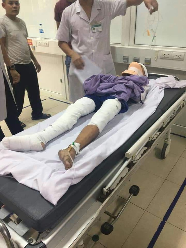 Kinh hoàng bé trai bị phóng điện phải tháo bỏ cả 2 tay tại Nghệ An! - 3 Kinh hoàng bé trai bị phóng điện phải tháo bỏ cả 2 tay tại Nghệ An! - 3