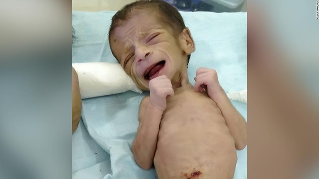 Bé gái 4 ngày tuổi sống sót kỳ diệu sau khi bị chôn sống - 1 Bé gái 4 ngày tuổi sống sót kỳ diệu sau khi bị chôn sống - 1