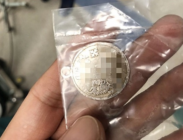 Mặt dây chuyền mắc ngang cổ họng, bé trai suýt tử vong - 2 Mặt dây chuyền mắc ngang cổ họng, bé trai suýt tử vong - 2