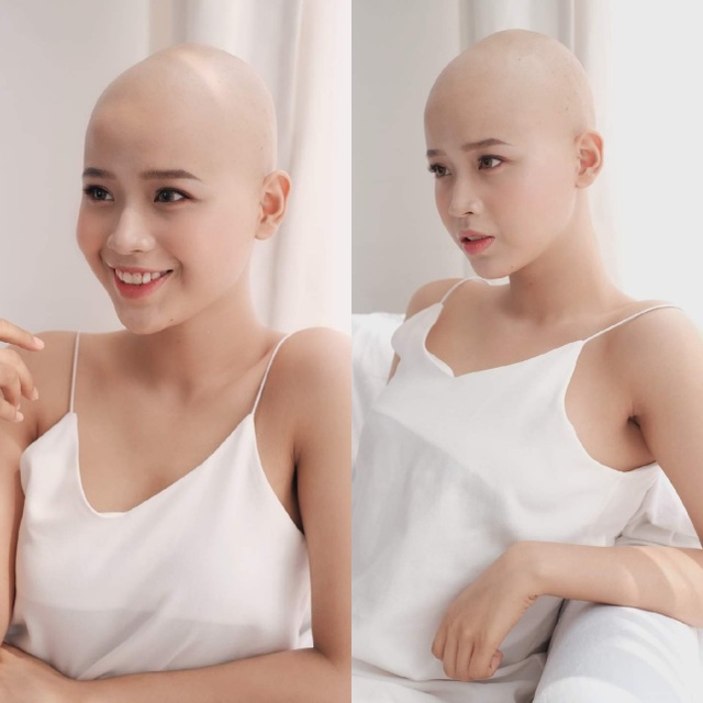 Thủy Tiên - nữ sinh mắc bệnh ung thư dự thi sắc đẹp ĐH Ngoại thương - 1 Thủy Tiên - nữ sinh mắc bệnh ung thư dự thi sắc đẹp ĐH Ngoại thương - 1