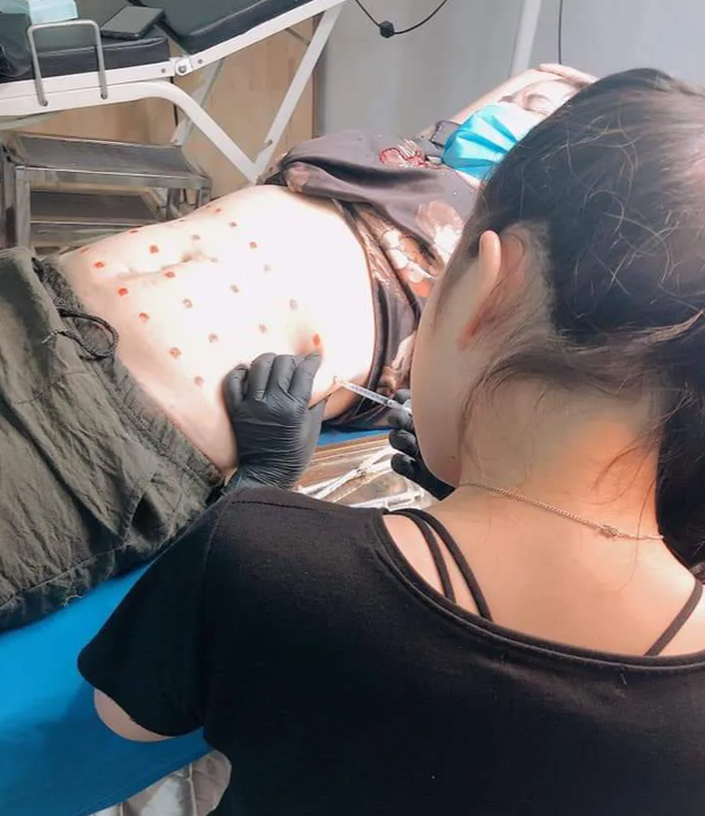 Bị thẩm mỹ dỏm “đại náo”, ngành y tế hớt hải dẹp loạn - 4 Bị thẩm mỹ dỏm “đại náo”, ngành y tế hớt hải dẹp loạn - 4