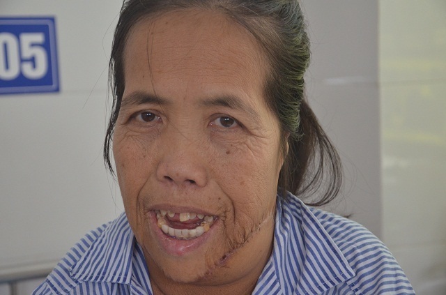 Người đàn bà có hàm răng kì dị lần đầu ngoái cổ sau nửa thế kỉ: Em sợ mẹ không nhận ra - 4 Người đàn bà có hàm răng kì dị lần đầu ngoái cổ sau nửa thế kỉ: Em sợ mẹ không nhận ra - 4