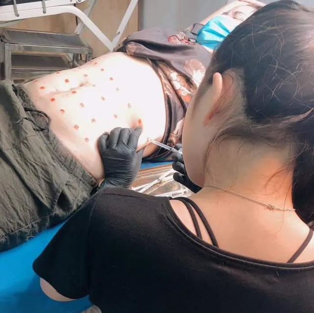 Vén “bức màn chết chóc” sau nhiều ca phẫu thuật thẩm mỹ tử vong - 1 Vén “bức màn chết chóc” sau nhiều ca phẫu thuật thẩm mỹ tử vong - 1