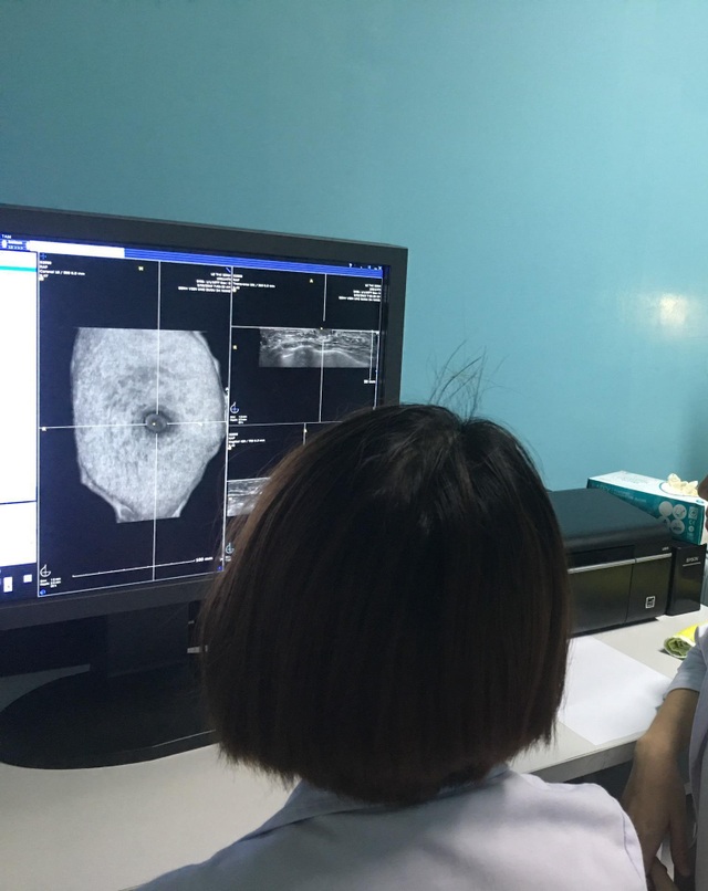 Những quan điểm sai lầm trong tầm soát bệnh ung bướu - 1 Những quan điểm sai lầm trong tầm soát bệnh ung bướu - 1