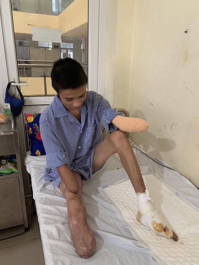 Ông bố trẻ bị điện cao thế phóng cụt tay chân được giúp đỡ hơn 120 triệu đồng - 2 Ông bố trẻ bị điện cao thế phóng cụt tay chân được giúp đỡ hơn 120 triệu đồng - 2
