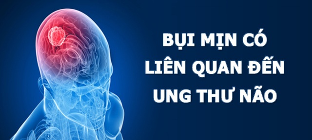 Phát hiện mới: Bụi mịn có mối liên quan tới nguy cơ mắc ung thư não - 2