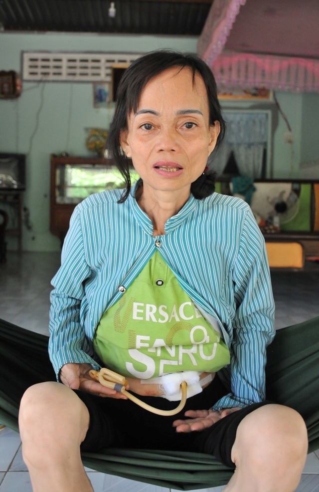 Lên nhà con gái chơi, người mẹ suýt chết vì uống nhầm chai hoá chất - 2 Lên nhà con gái chơi, người mẹ suýt chết vì uống nhầm chai hoá chất - 2