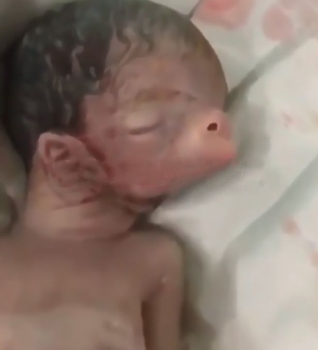 Em bé sinh ra với tai và mũi lợn - 1