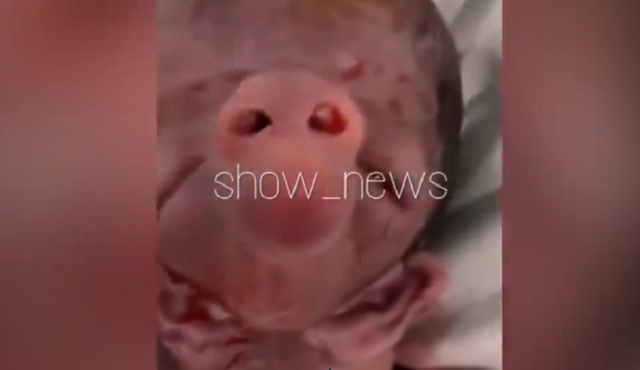 Em bé sinh ra với tai và mũi lợn - 2