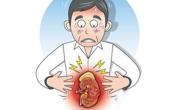 13 dấu hiệu trên cơ thể cảnh báo ung thư thận ngầm phát triển mạnh mẽ - 4 13 dấu hiệu trên cơ thể cảnh báo ung thư thận ngầm phát triển mạnh mẽ - 4
