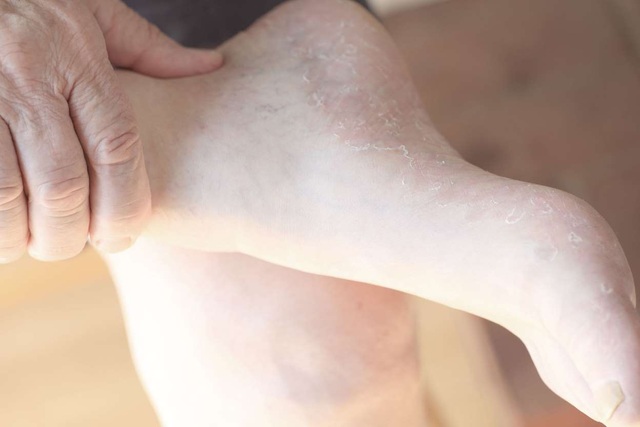 Bàn chân tiết lộ 10 dấu hiệu kín đáo của bệnh - 1